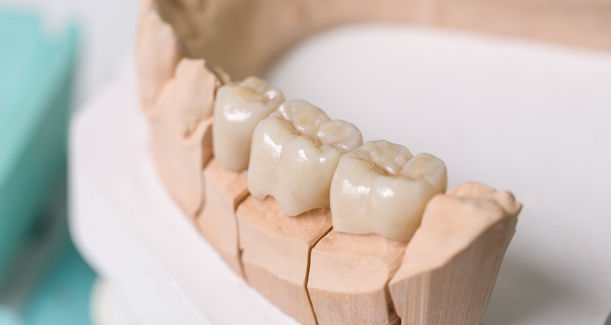 Hammaslaboratorio Terho Parikka Ky